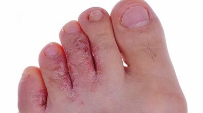 Typen und Phasen der Beinentwicklung in den Beinen